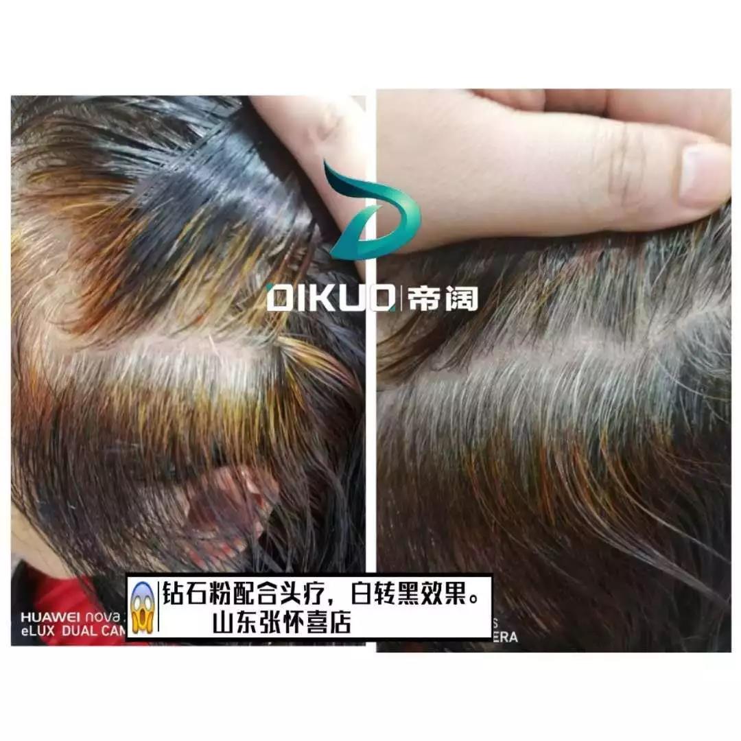 植物养发加盟