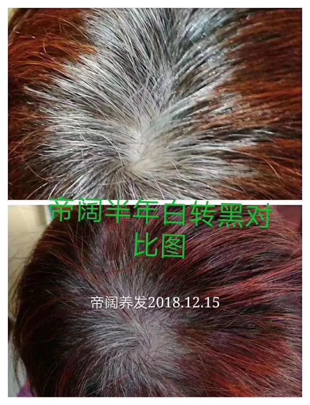 植物养发加盟