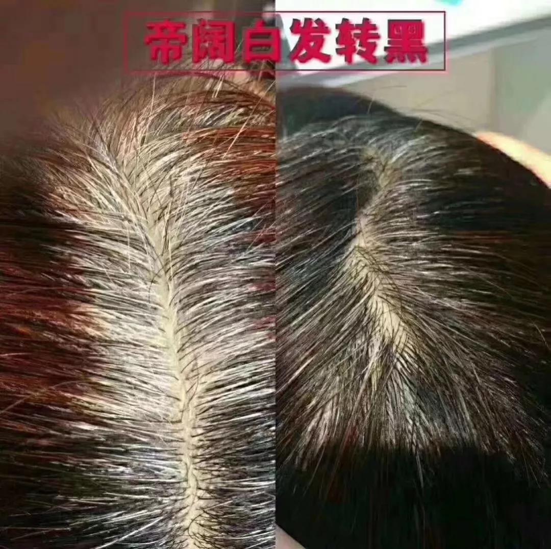 植物养发加盟